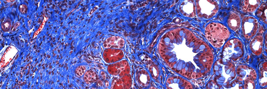 Reginald Hill banner