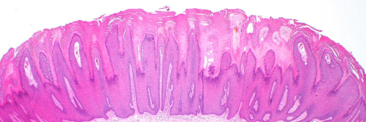 UAMS Dermpath (@DermpathUAMS) / Posts / X