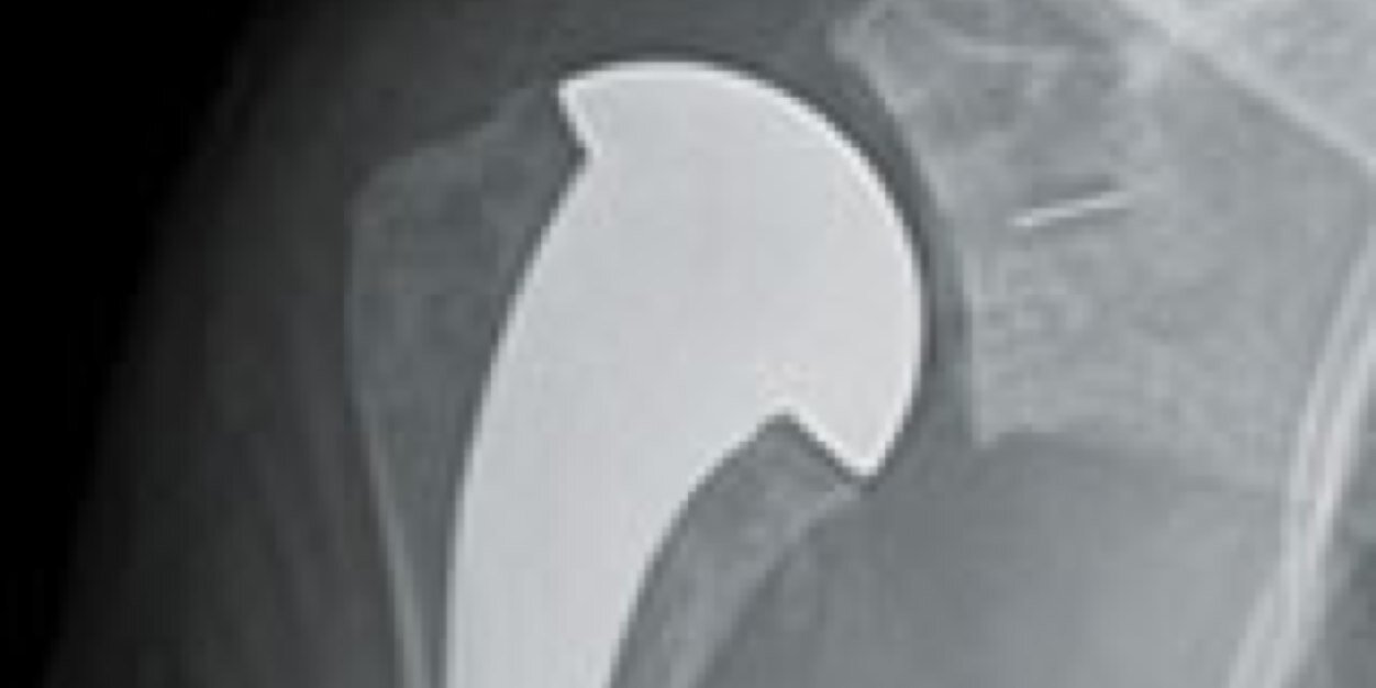 PHCshoulderdoc's profile banner image