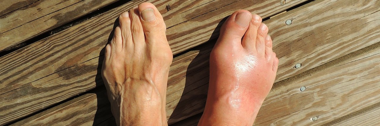 Gout Solution banner