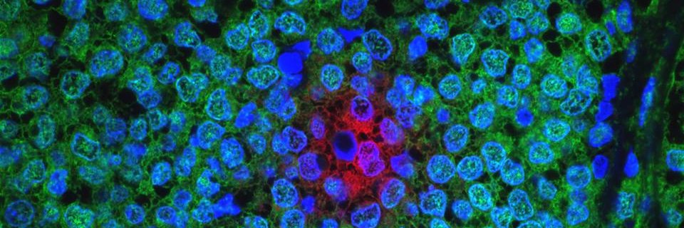 Alliance for Clinical Trials in Oncology's banner