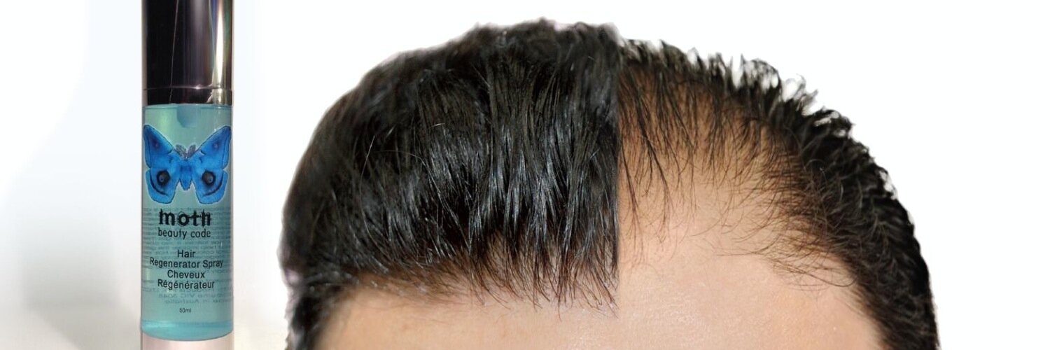 doctorHAIRLOSS's profile banner image