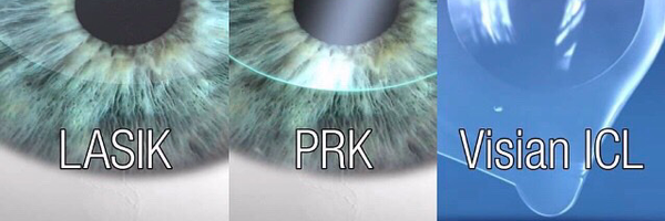 sharpevision Profile Banner