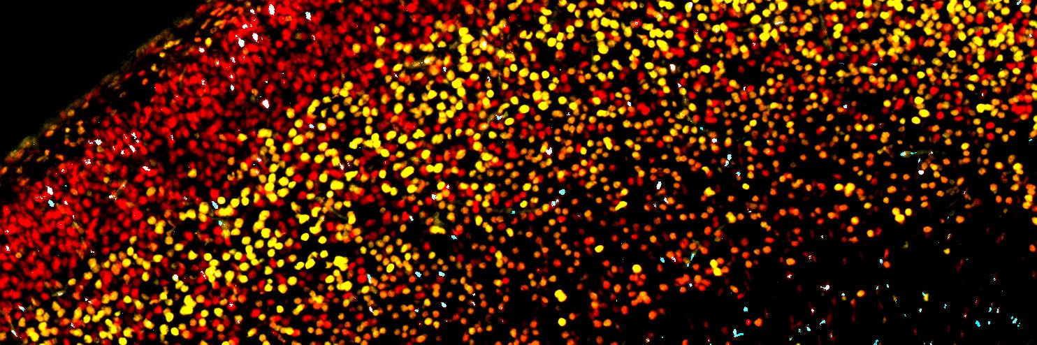 Jiayang (Wiki) Chen, PhD banner