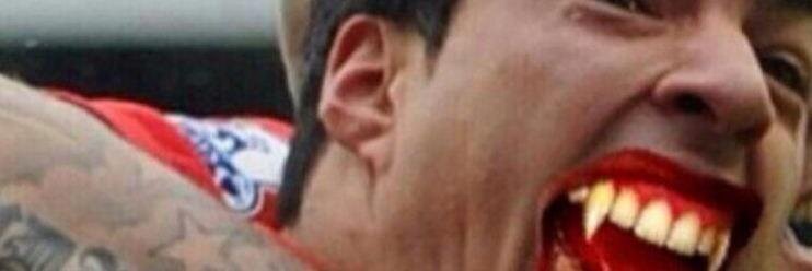 liam mc banner