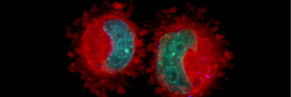 OISB_IBSO Profile Banner