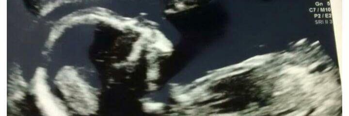 LauraJaneBirket's profile banner image