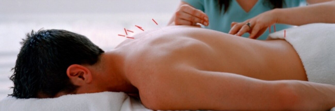 AcupunctureMen's profile banner image