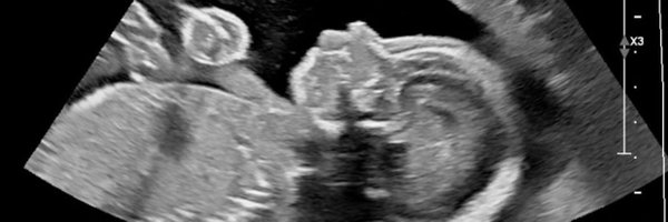 mandamommy Profile Banner
