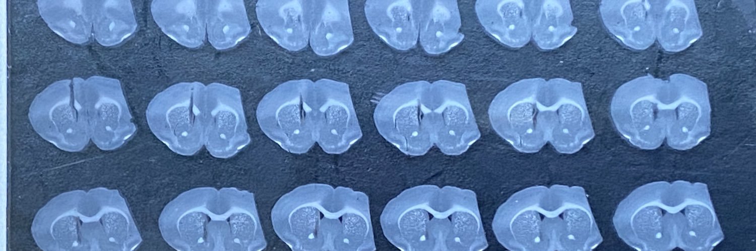 Lauren Burgeno, PhD 🇺🇸➡️🇬🇧👩‍🔬🧠💉🔬🧀🍺 banner