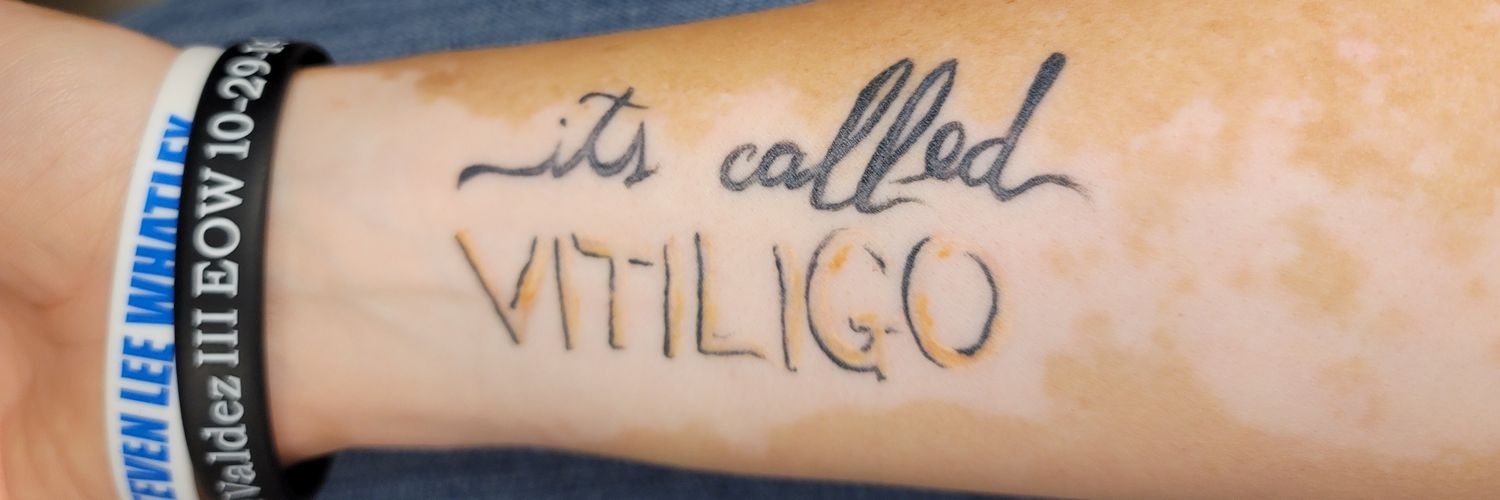 vitiligan36's profile banner image