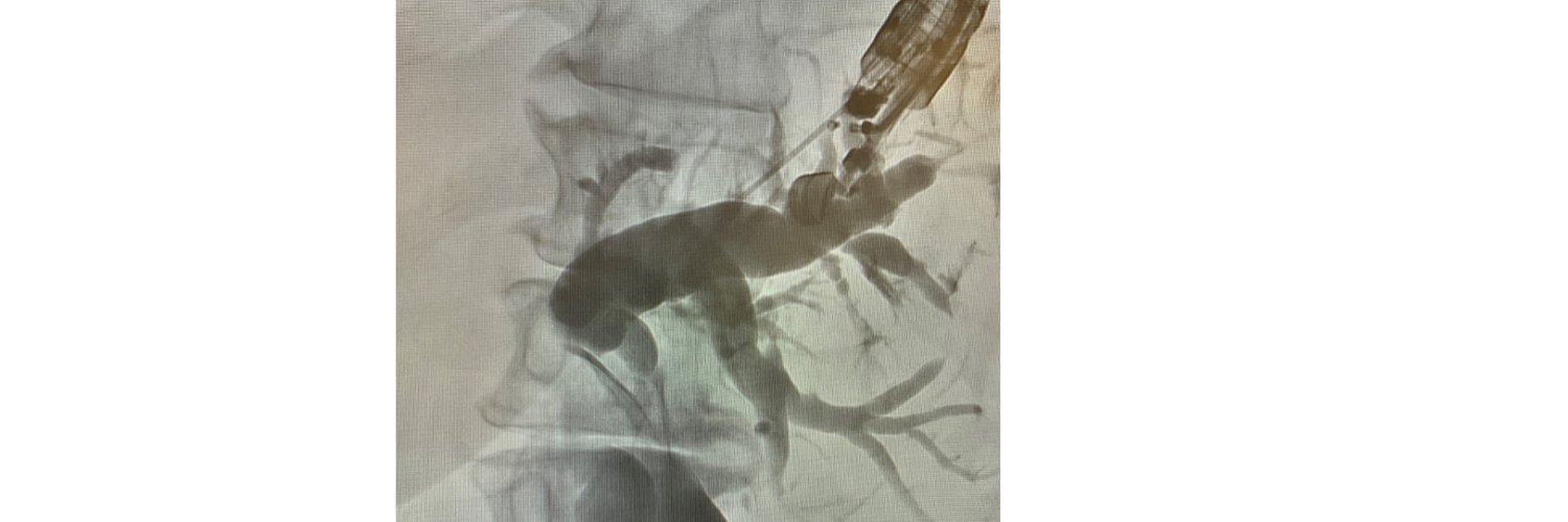 Todd H Baron MD, MASGE banner