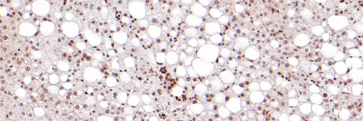 Bruno Ramos-Molina, PhD banner