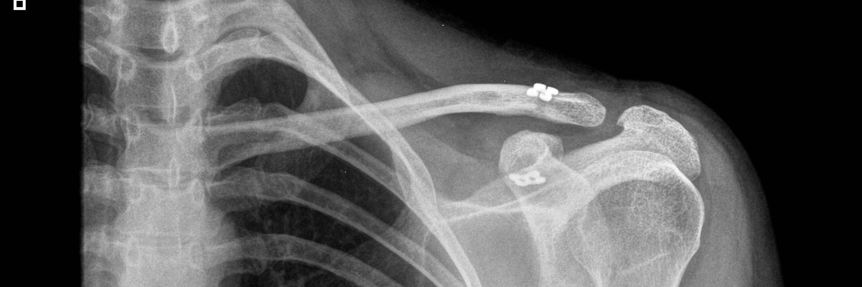 Charlie Talbot banner