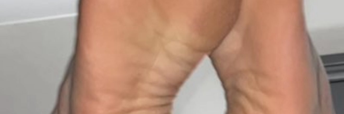 Thick boy in London banner