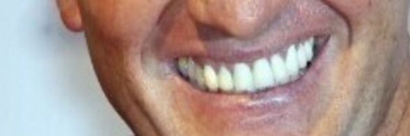 Brendan’s Teeth banner
