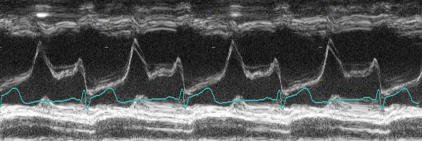 Temple Point-of-Care Ultrasound banner