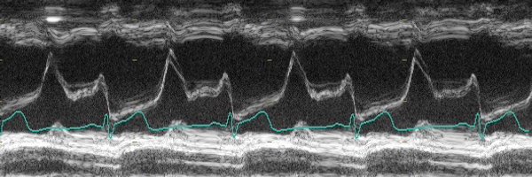 TemplePOCUS Profile Banner