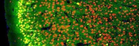 Sierra Simpson banner