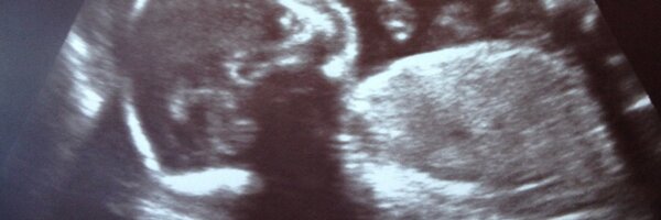 ERockMUT Profile Banner