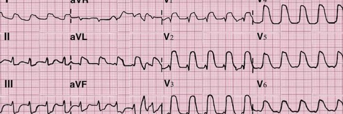 Casey Patrick banner