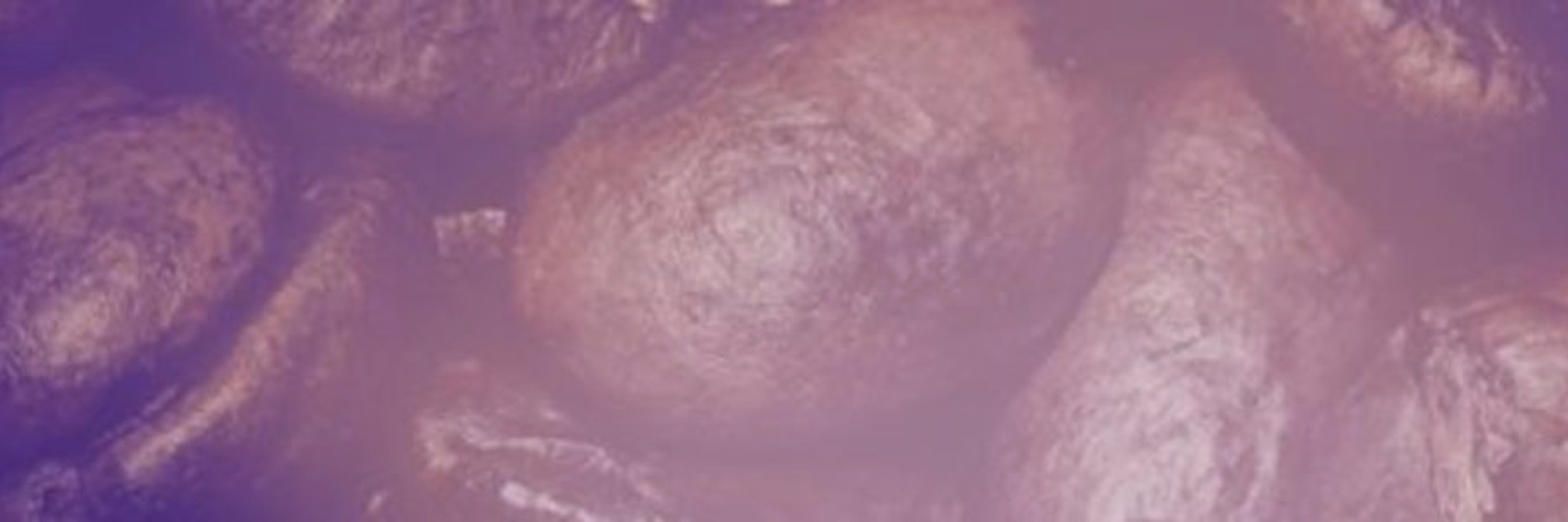 Overtired Podcast banner