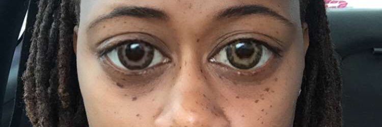 2_Freckles's profile banner image