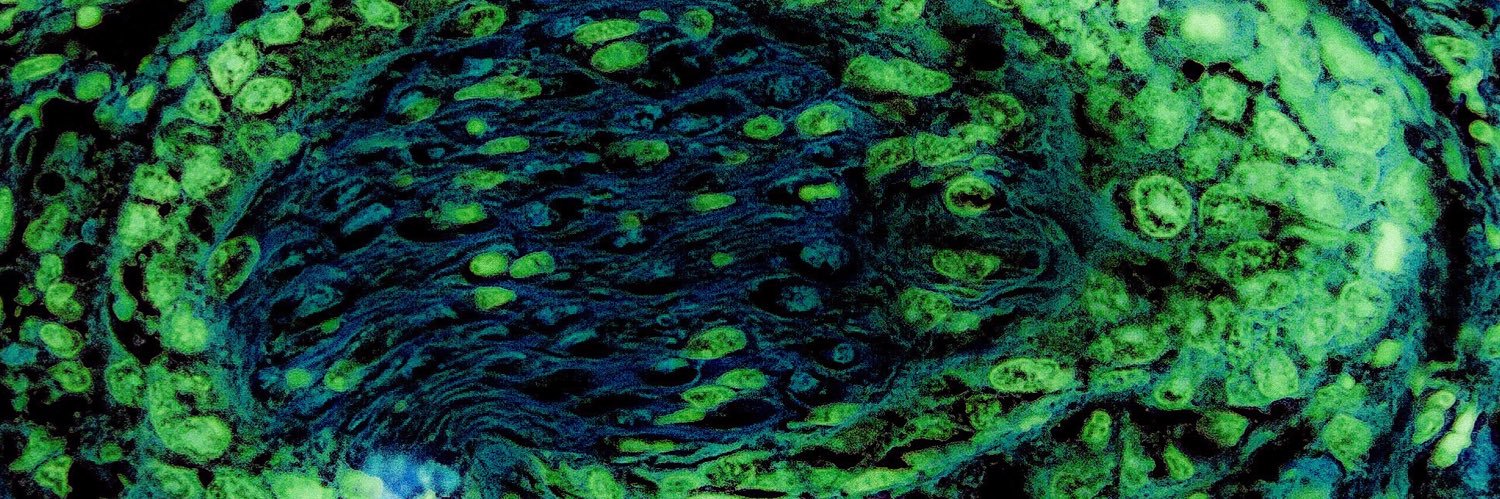 René Martínez Flores banner