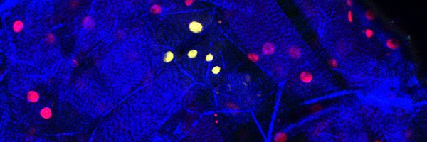 EdinCRC Profile Banner