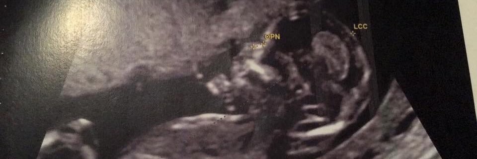 OPhlpe's profile banner image