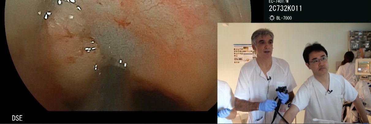 DIGESTIVE ENDOSCOPY banner