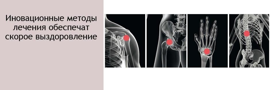 Лечение в Германии banner