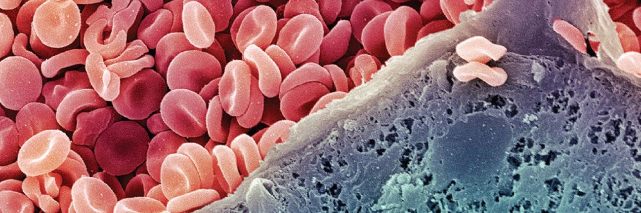 The Lancet Haematology's banner