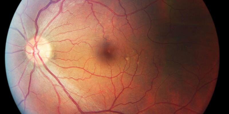optivision2020's profile banner image