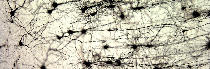 NeuroCarleton banner