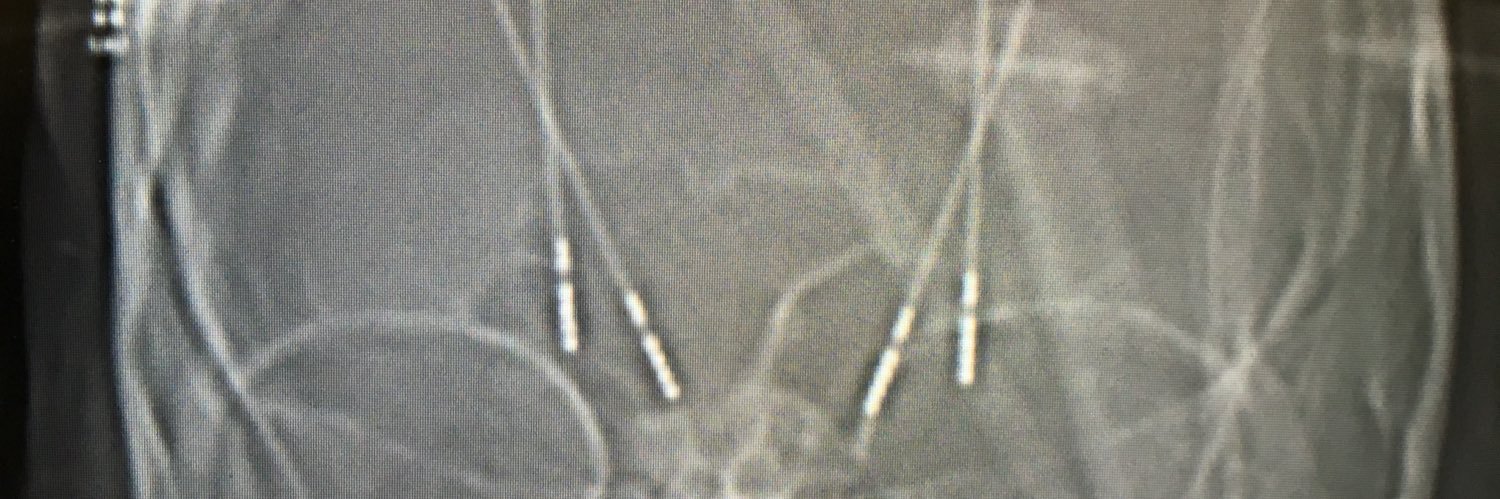 Erlick Pereira banner