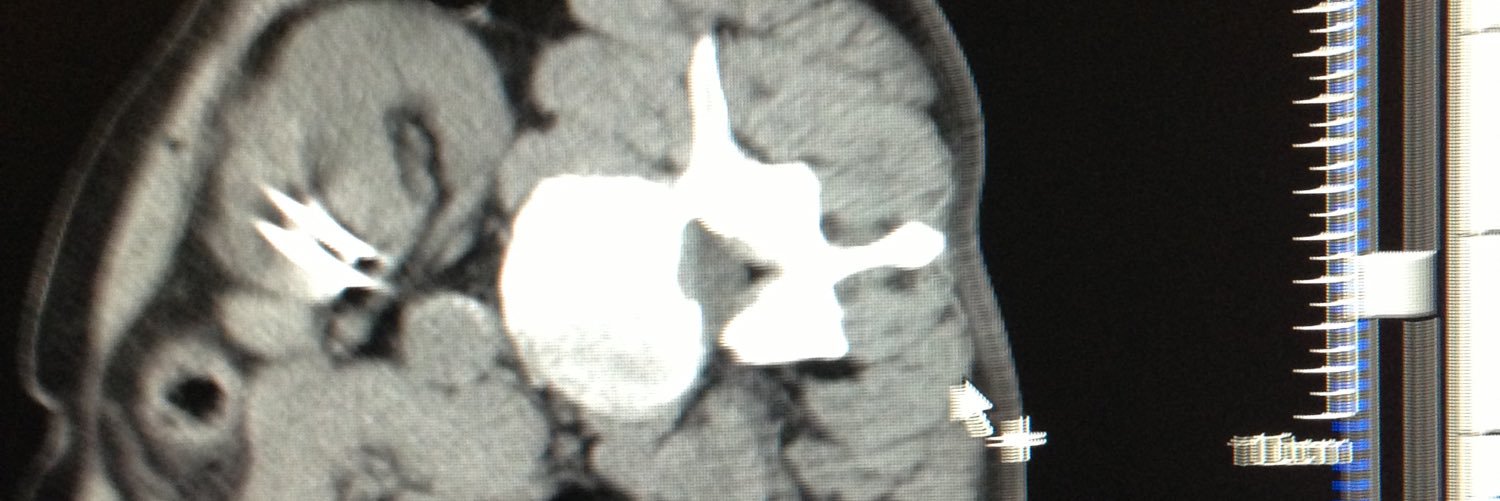 Roger Williams_IR banner