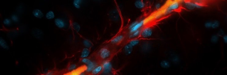 Ellen Parker, MD PhD banner