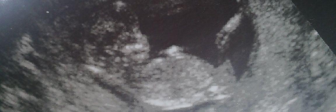bbygrlback's profile banner image