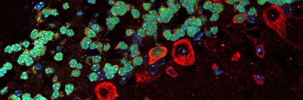 Jessica Verpeut, PhD banner