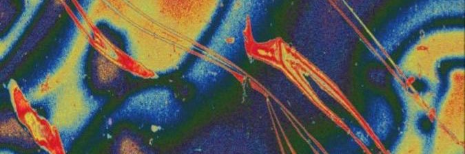 B banner