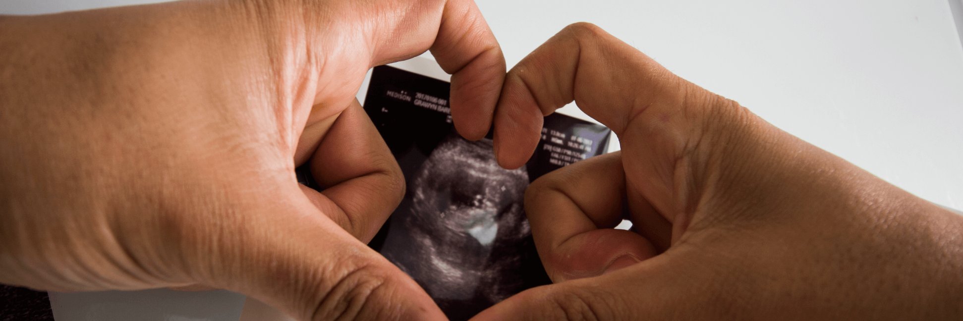 David Bareño banner