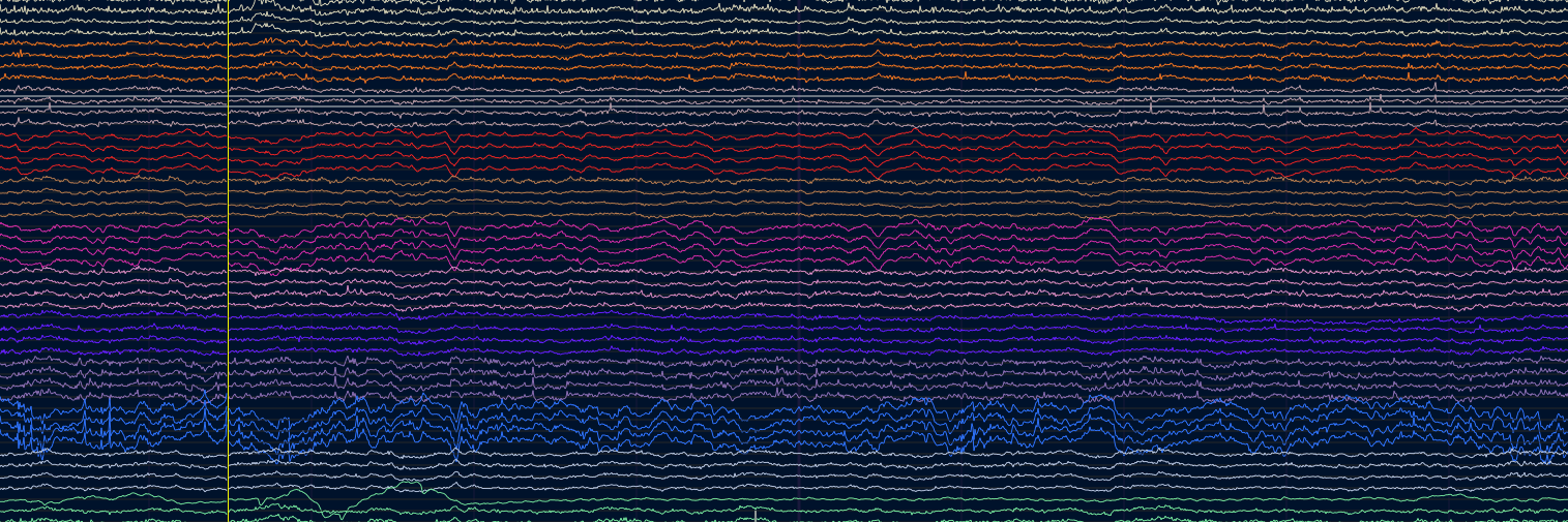 Open Ephys https://bsky.app/profile/openephys.bsky banner