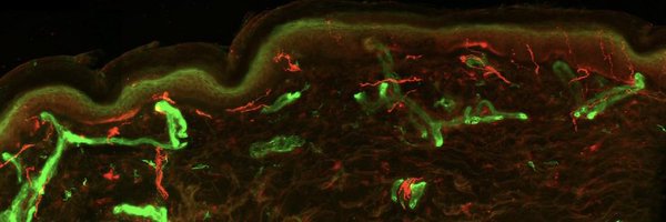 DEW_Neuropathy Profile Banner
