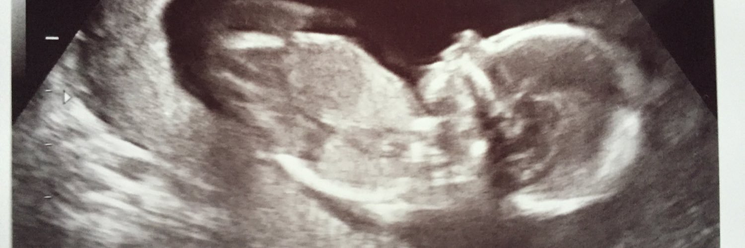 helloomayaax0's profile banner image