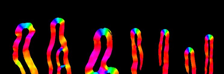 Michael Berks banner