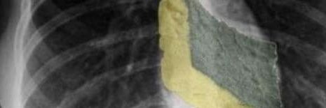 MACHE banner