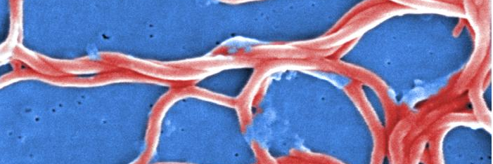 Infectious Diseases banner