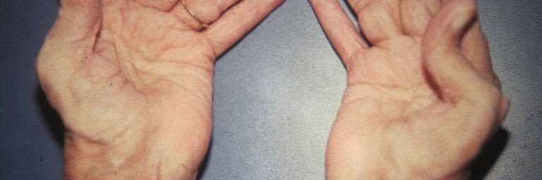 Rheumatology update banner