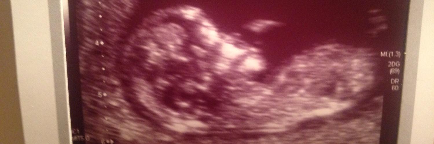 Grace_Annabel's profile banner image